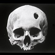 Cover image of Anterior Aspect of Cranium 9, From Huarochiri